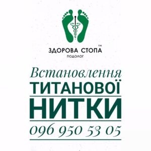 Встановлення титанової нитки