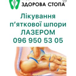 Лікування п'яткової шпори лазером