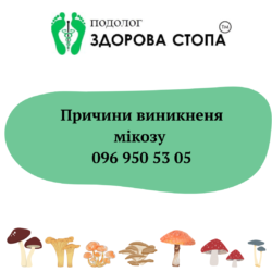 Причини виникнення мікозу