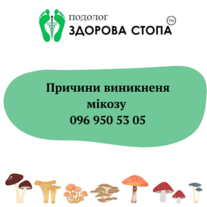 Причини виникнення мікозу