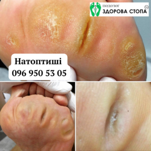 Натоптиші