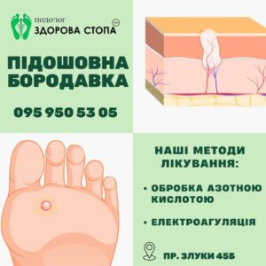 Долонно-підошовні бородавки