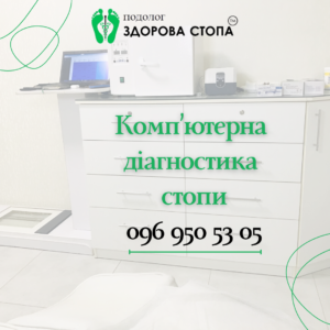 Комп’ютерна діагностика стопи
