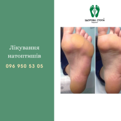 Про натоптиші