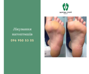 Про натоптиші