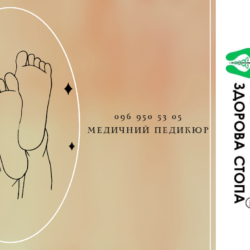 Медичний педикюр у Тернополі