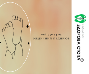 Медичний педикюр у Тернополі
