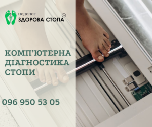 Комп’ютерна діагностика стопи
