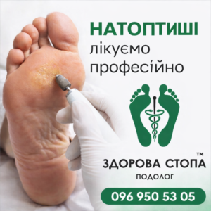 Чому з'являються натоптиші?