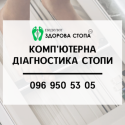 Комп'ютерна діагностика стопи