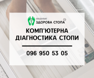 Комп'ютерна діагностика стопи