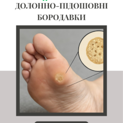 Долонно-підошовні бородавки