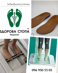 Індивідуальні корегуючі устілки