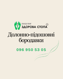 Долонно-підошовні бородавки