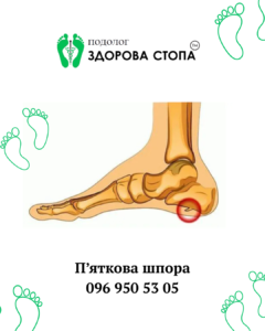 П'яткова шпора