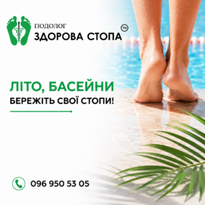 Як захистити свої ноги в теплий сезон