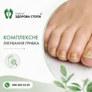 Лікування грибка нігтів