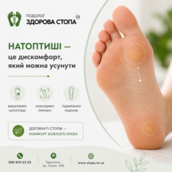 Чому з'являються натоптиші?